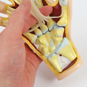 手根部では、屈筋腱を持ち上げて手根骨を観察できます