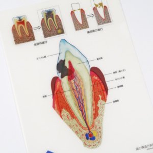 歯の構造と疾患