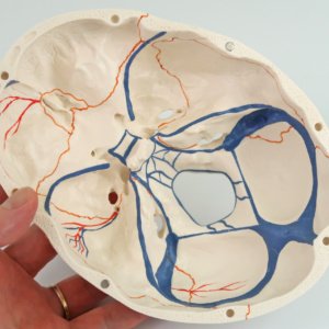 内頭蓋底：静脈洞なども表現