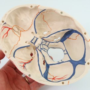 内頭蓋底：静脈洞なども表現