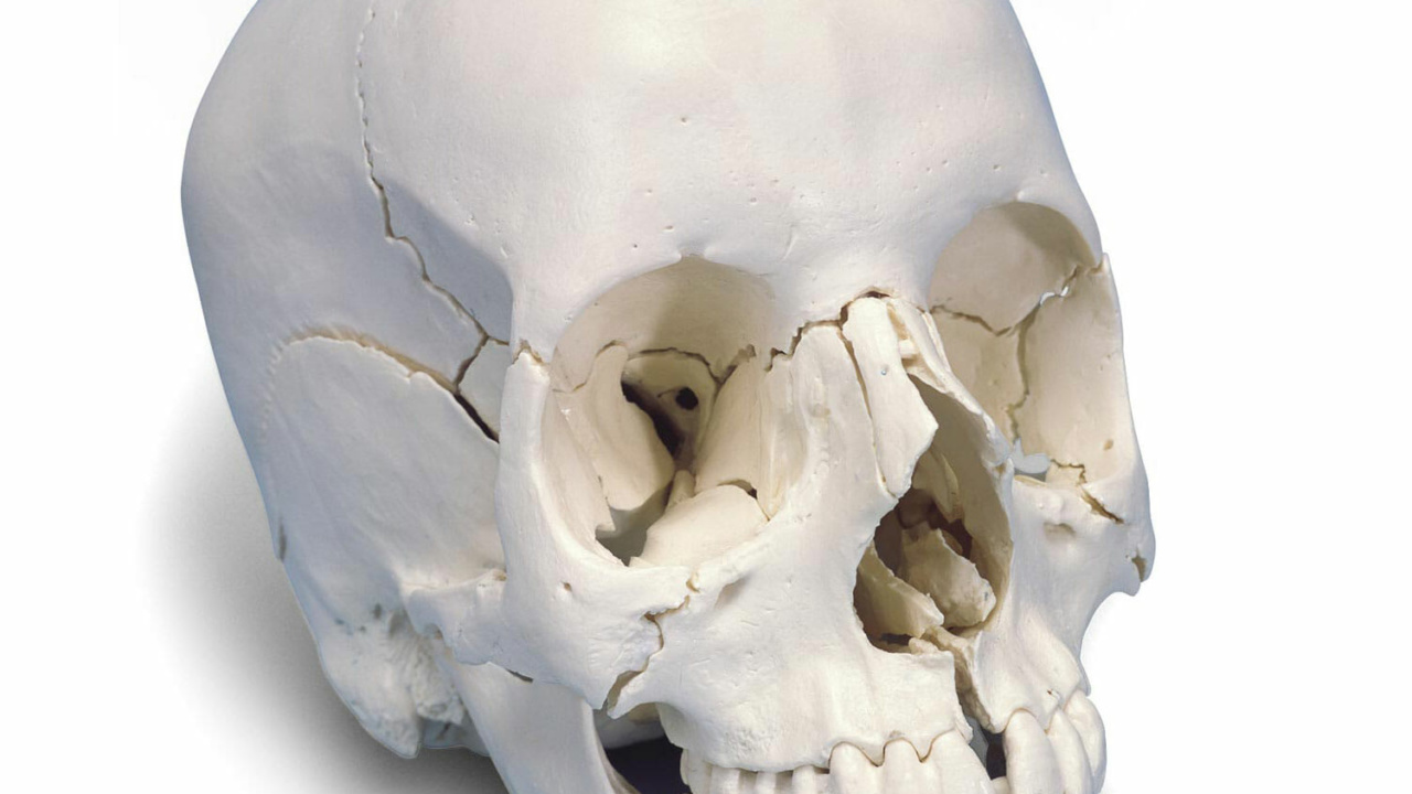 頭蓋骨22分解キット，ナチュラルカラー仕様 - 日本スリービー 