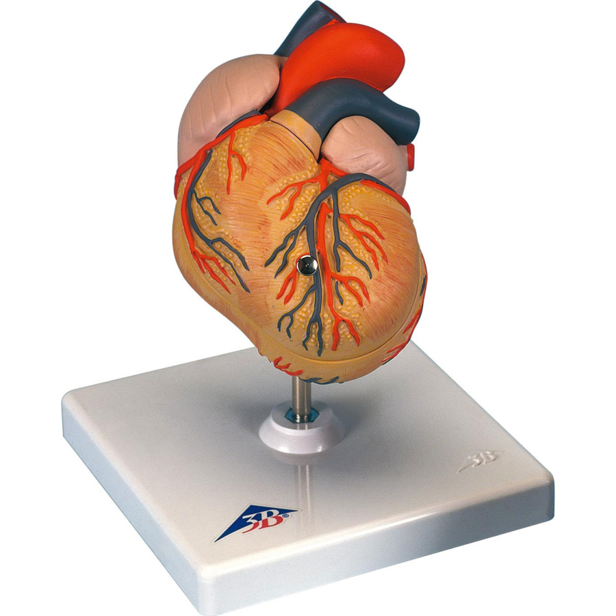 心臓，左心室肥大・2分解モデル - 日本スリービー・サイエンティ 