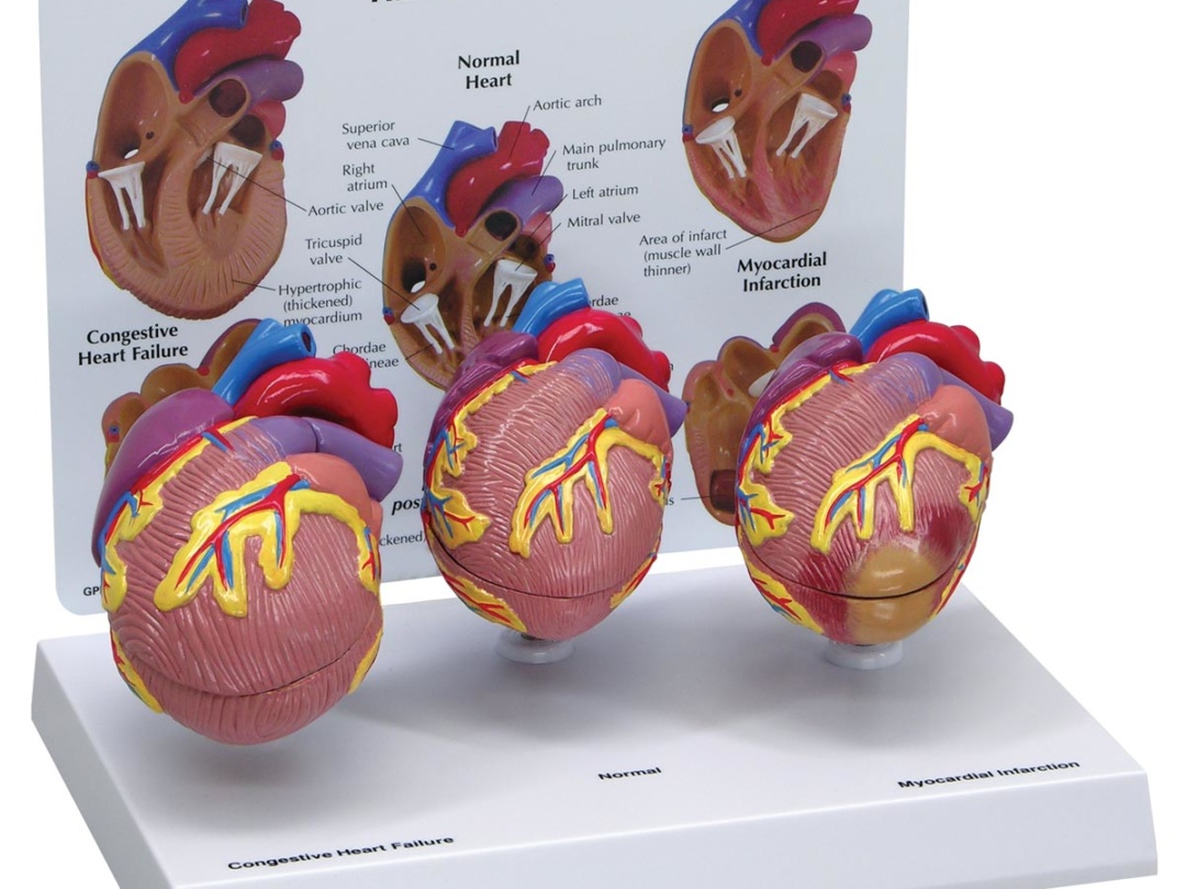 心臓模型 | 日本スリービー・サイエンティフィック