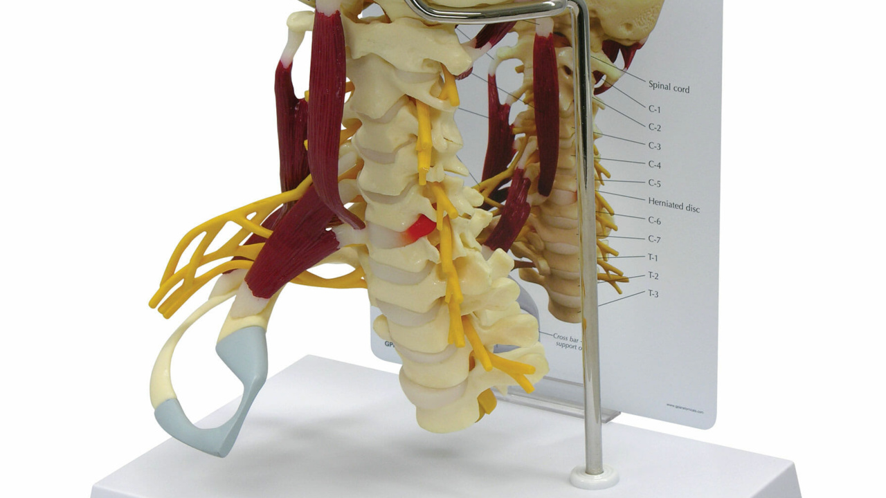 筋付き頚椎モデル | 日本スリービー・サイエンティフィック