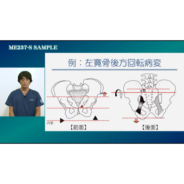 オステオパシー ・ テクニックシリーズ 骨盤の検査とMET - 日本 